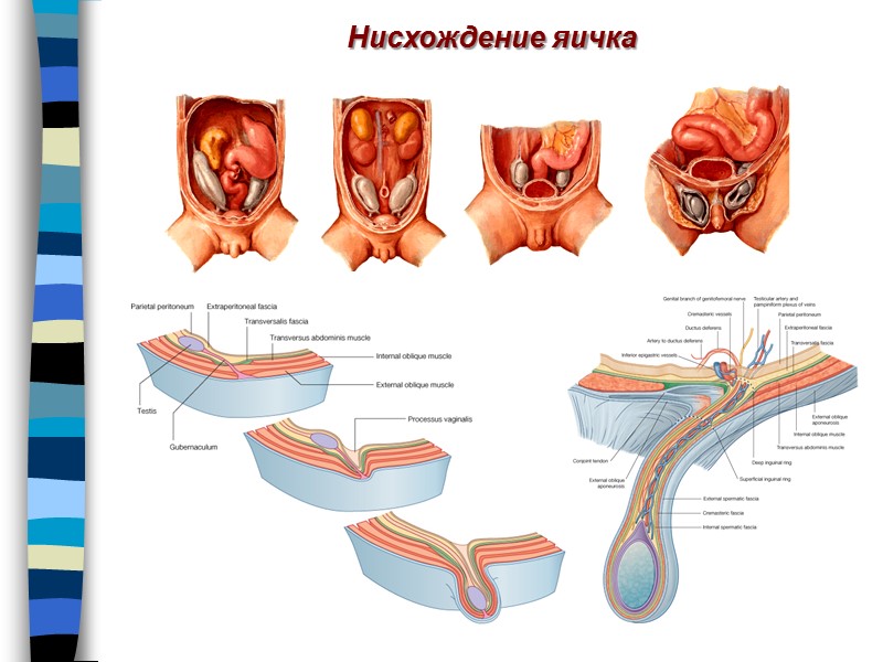 Нисхождение яичка